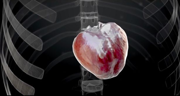 Powstaje pierwsze sztuczne serce. Planowane przeszczepy w 2028